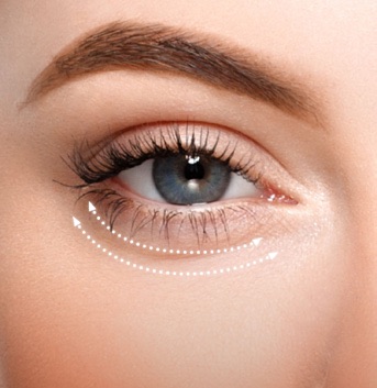 Augenkonturbehandlung mit EyeLift von Utsukusy