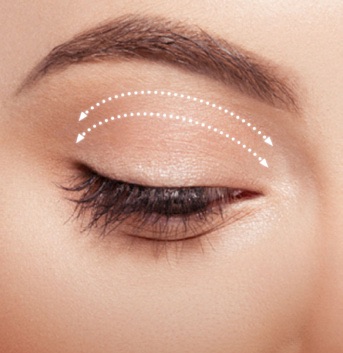 EyeLift - Oberlidstraffung